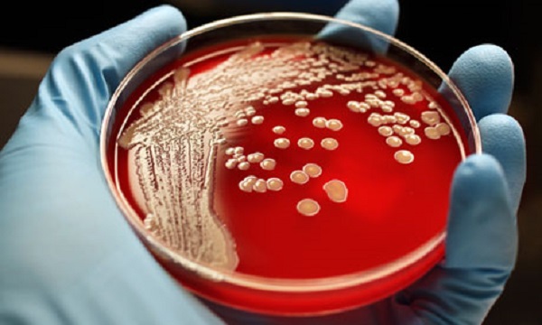 Antibiotic resistance burgeoning problem in South East Asia: WHO