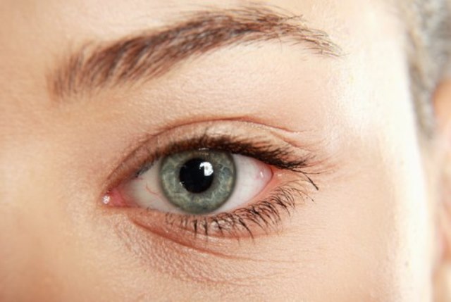 Simple remedies to remove under-eye wrinkles